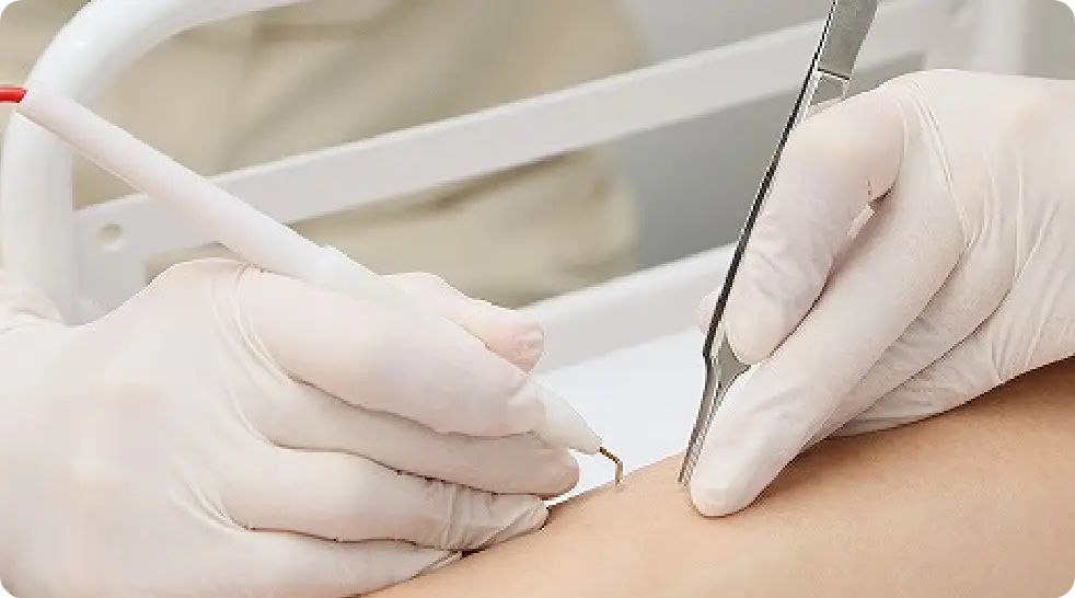 BEAUTY SKIN CLINIC（ビューティースキンクリニック） VIOパーフェクト医療脱毛セット