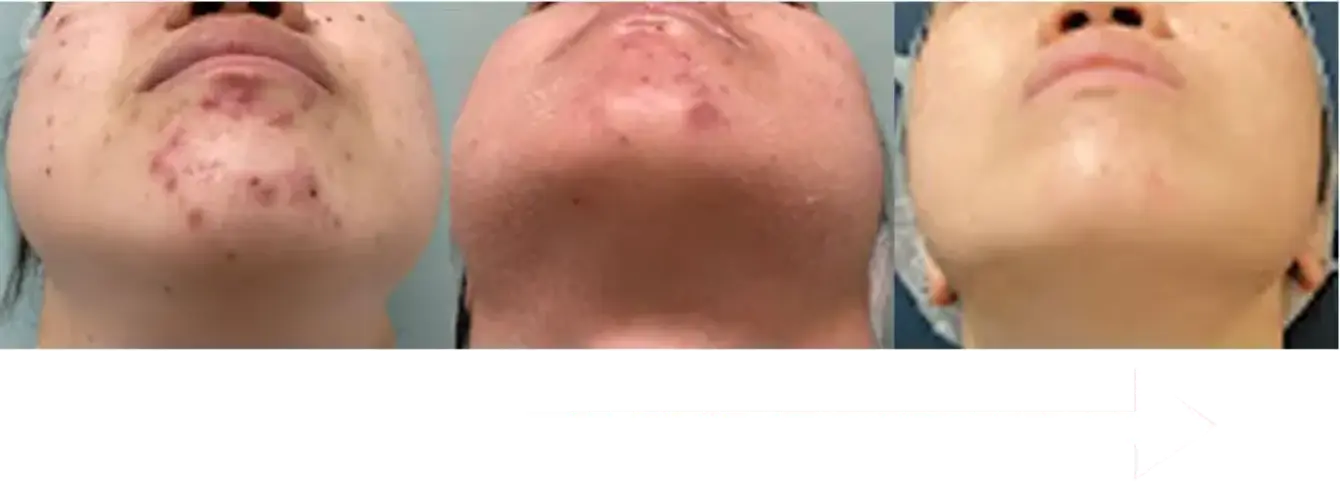 BEAUTY SKIN CLINIC（ビューティースキンクリニック） ゼオスキン