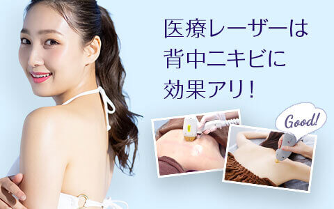 医療レーザーの背中脱毛はニキビにも効果アリ
