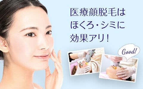 医療顔脱毛はホクロ・シミにも効果アリ ニキビも大丈夫