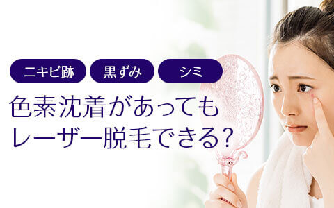 レーザー脱毛は色素沈着があってもできるの？ 改善されるの？