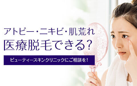 アトピーやニキビ、敏感肌、肌荒れでも脱毛はできる？